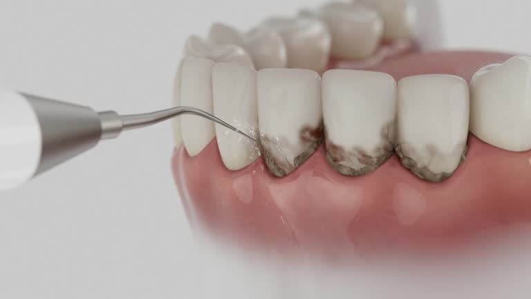Reliable Dental Implants contractor in Hamilton, MO by Smile Center Dentistry
